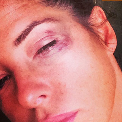 Kelly Monaco injured in fall